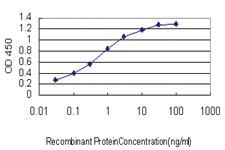 Anti-SLC35A3 Mouse Monoclonal Antibody [clone: 4B6]