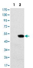 Anti-RBP4 Mouse Monoclonal Antibody [clone: 4C2]