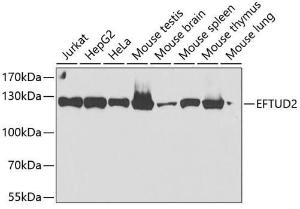 Western blot analysis of extracts of various cell lines, using Anti-EFTUD2 Antibody (A12061) at 1:2,000 dilution. The secondary antibody was Goat Anti-Rabbit IgG H&L Antibody (HRP) at 1:10,000 dilution.