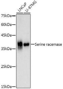 Western blot analysis of extracts of various cell lines, using Anti-Serine racemase Antibody [ARC3047] (A309468) at 1:1,000 dilution. The secondary antibody was Goat Anti-Rabbit IgG H&L Antibody (HRP) at 1:10,000 dilution.