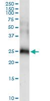 Anti-CD70 Rabbit Polyclonal Antibody