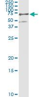 Anti-PGM3 Mouse Monoclonal Antibody [clone: 1E2-1B12]