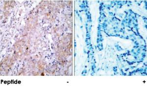 Anti-EGFR Rabbit Polyclonal Antibody