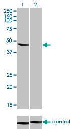 Anti-ENOB Mouse monoclonal antibody [clone: 5D1]