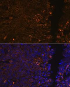 Anti-Cytokeratin 13 Rabbit Monoclonal Antibody [clone: ARC1824]