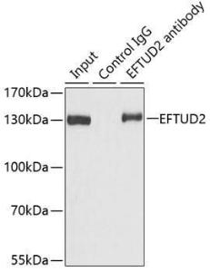 Immunoprecipitation analysis of 100µg extracts of 293T cells using 3µg of Anti-EFTUD2 Antibody (A12061). This Western blot was performed on the immunoprecipitate using Anti-EFTUD2 Antibody (A12061) at a dilution of 1:1000.