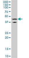 Anti-LHX5 Mouse Monoclonal Antibody [clone: 2B11]