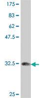 Anti-TOP1 Mouse Polyclonal Antibody