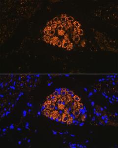 Anti-Cytokeratin 13 Rabbit Monoclonal Antibody [clone: ARC1824]