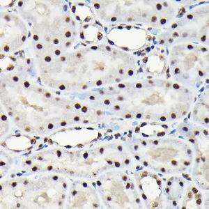 Immunohistochemistry analysis of paraffin-embedded rat kidney using Anti-EFTUD2 Antibody (A12061) at a dilution of 1:100 (40x lens). Perform high pressure antigen retrieval with 10 mM citrate buffer pH 6.0 before commencing with IHC staining protocol.