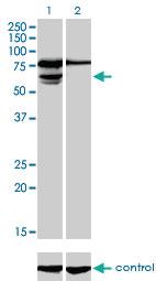 Anti-PGM3 Mouse Monoclonal Antibody [clone: 1E2-1B12]