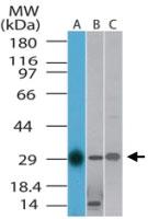 Anti-TLX1 Rabbit Polyclonal Antibody