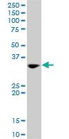 Anti-TOLLIP Rabbit Polyclonal Antibody