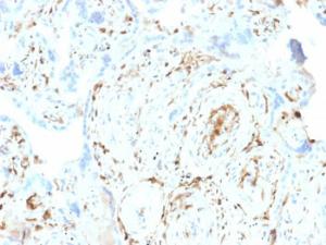 Immunohistochemical analysis of formalin-fixed, paraffin-embedded human placenta using Anti-S100A2 Antibody [CPTC-S100A2-2]