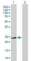 Anti-CD74 Rabbit Polyclonal Antibody