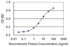 Anti-SF3B3 Mouse Monoclonal Antibody [clone: 2F1]