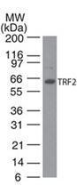 Anti-TERF2 Mouse Monoclonal Antibody (Unconjugated) [clone: 4A794.15]