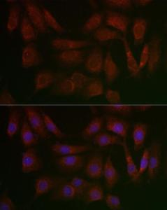 Immunofluorescence analysis of NIH/3T3 cells using Anti-PERK Antibody (A306749) at a dilution of 1:100 (40X lens). DAPI was used to stain the cell nuclei (blue)