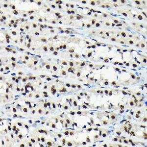 Immunohistochemistry analysis of paraffin-embedded rat stomach using Anti-EFTUD2 Antibody (A12061) at a dilution of 1:100 (40x lens). Perform high pressure antigen retrieval with 10 mM citrate buffer pH 6.0 before commencing with IHC staining protocol.