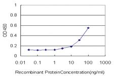 Anti-PGM3 Mouse Monoclonal Antibody [clone: 1E2-1B12]