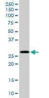 Anti-PCGF1 Rabbit Polyclonal Antibody