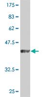 Anti-DUSP3 Mouse Monoclonal Antibody [clone: 5B7]