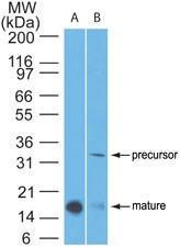 Anti-IL1B Mouse Monoclonal Antibody [clone: 43N1G6]