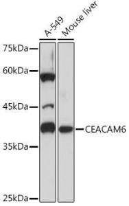 Western blot analysis of extracts of various cell lines, using Anti-CEACAM6 Antibody [ARC2110] (A306750) at 1:1000 dilution. The secondary Antibody was Goat Anti-Rabbit IgG H&L Antibody (HRP) at 1:10000 dilution