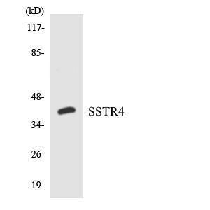 Western blot analysis of the lysates from HepG2 cells using Anti-SSTR4 Antibody