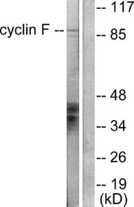 Anti-Cyclin F antibody