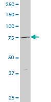 Anti-ABCB9 Mouse Polyclonal Antibody