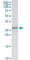 Anti-TOLLIP Rabbit Polyclonal Antibody