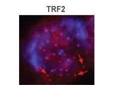 Anti-TERF2 Mouse Monoclonal Antibody (Unconjugated) [clone: 4A794.15]