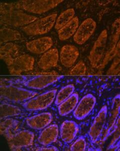 Immunofluorescence analysis of rat rectum cells using Anti-CEACAM6 Antibody [ARC2110] (A306750) at a dilution of 1:100 (40X lens). DAPI was used to stain the cell nuclei (blue)