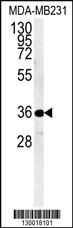 Anti-MYOZ1 Rabbit Polyclonal Antibody