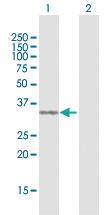 Anti-SULT1E1 Rabbit Polyclonal Antibody