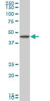 Anti-LHX5 Mouse Monoclonal Antibody [clone: 2B11]