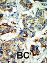 Anti-NEK4 Rabbit Polyclonal Antibody