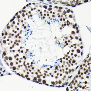 Immunohistochemistry analysis of paraffin-embedded mouse testis using Anti-EFTUD2 Antibody (A12061) at a dilution of 1:100 (40x lens). Perform high pressure antigen retrieval with 10 mM citrate buffer pH 6.0 before commencing with IHC staining protocol.