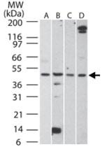 Anti-AURKA Rabbit Polyclonal Antibody