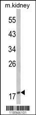 Anti-PTHLH Rabbit Polyclonal Antibody (APC (Allophycocyanin))