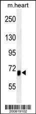 Anti-ACVR1B Mouse Monoclonal Antibody (AP (Alkaline Phosphatase)) [clone: 179CT11.2.1]