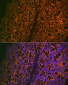 Immunofluorescence analysis of mouse large intestine cells using Anti-CEACAM6 Antibody [ARC2110] (A306750) at a dilution of 1:100 (40X lens). DAPI was used to stain the cell nuclei (blue)