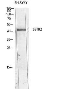 Anti-Somatostatin Receptor 2 Rabbit Polyclonal Antibody