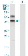 Anti-ART3 Mouse Monoclonal Antibody [clone: 1D2]