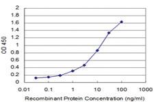 Anti-GTF2H1 Mouse Monoclonal Antibody [clone: 4B9]