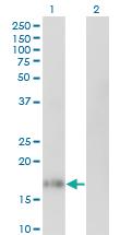 Anti-IL10 Mouse Monoclonal Antibody [clone: 1C10]