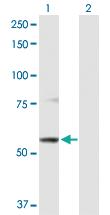 Anti-ABCB9 Rabbit Polyclonal Antibody