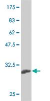 Anti-KLF13 Mouse Monoclonal Antibody [clone: 1D3]