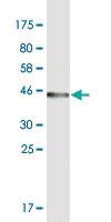 Anti-ODAM Mouse Monoclonal Antibody [clone: 2F8]